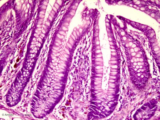 Figura E108. Intestino tenue umano a più forte ingrandimento