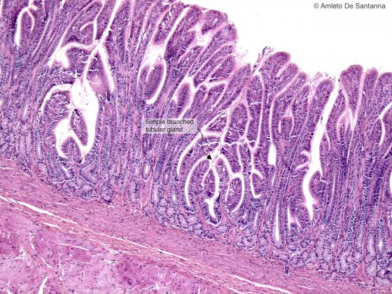 Figure E117. Human stomach