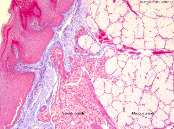 Figure E126. Human fetal tongue at higher magnification