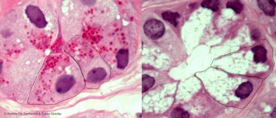 Figura E134. Montaggio di due micrografie