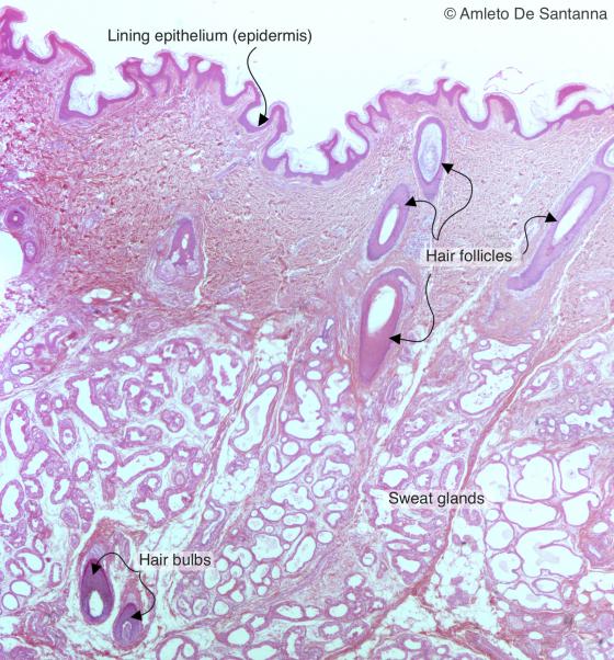 Figure E141. Human skin