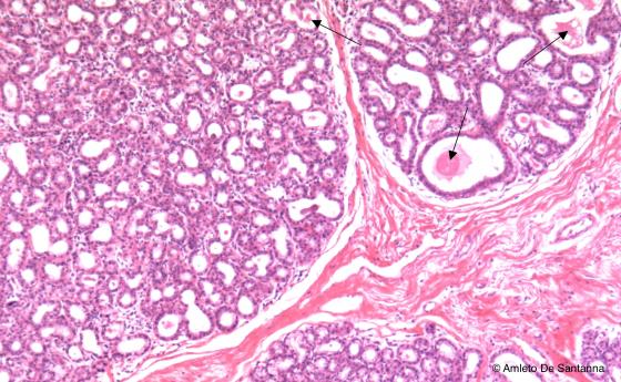 Figura E153. Ghiandola mammaria umana