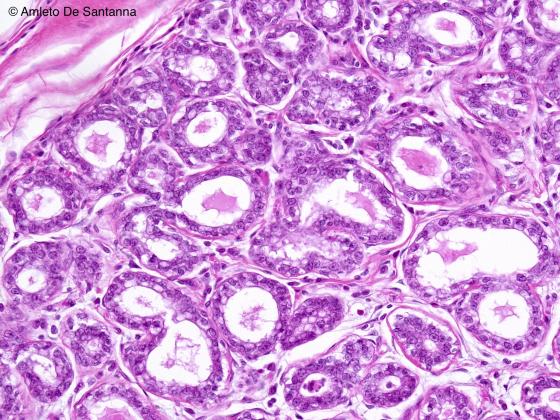 Figura E155. Ghiandola mammaria umana in lattazione