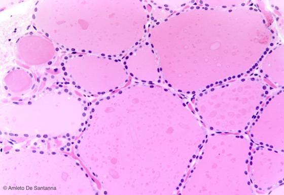 Figura E163. Tiroide umana a più forte ingrandimento