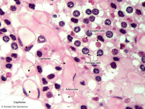 Figure E166A. Human parathyroid gland