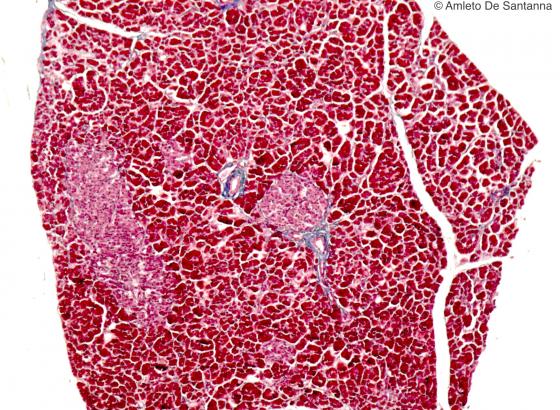 Figura E168. Pancreas umano