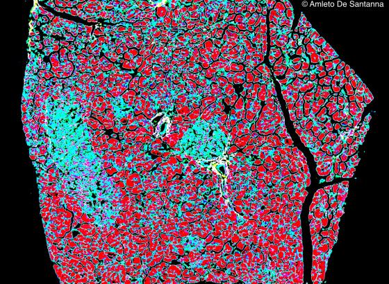 Figura E169. Pancreas umano