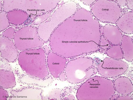 Figure E17A. Human thyroid
