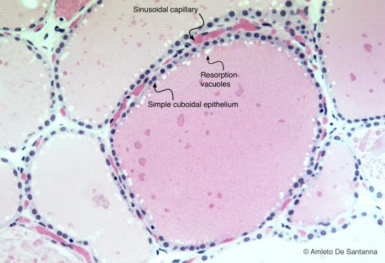 Figure E18. Human thyroid