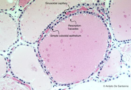 Figure E18. Human thyroid