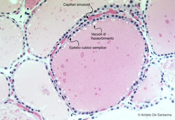 Figura E18. Ghiandola tiroide umana