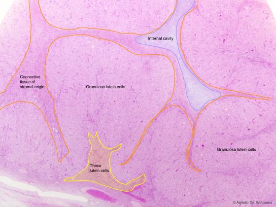 Figure E184A. Human corpus luteum during pregnancy