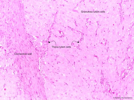 Figure E185. Human corpus luteum during pregnancy