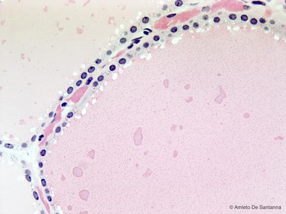 Figura E19. Ghiandola tiroide umana