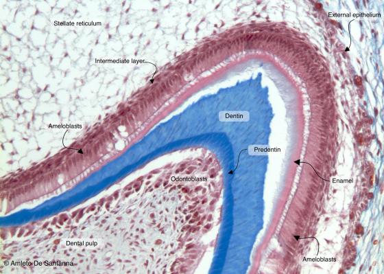 Figure E200. Human fetal tooth bud