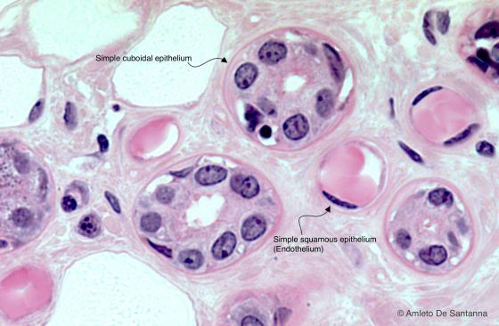 Figure E21. Human parotid gland