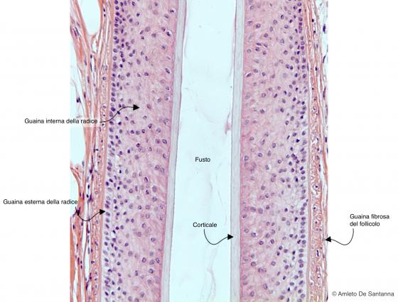 Figura E214. Cuoio capelluto umano