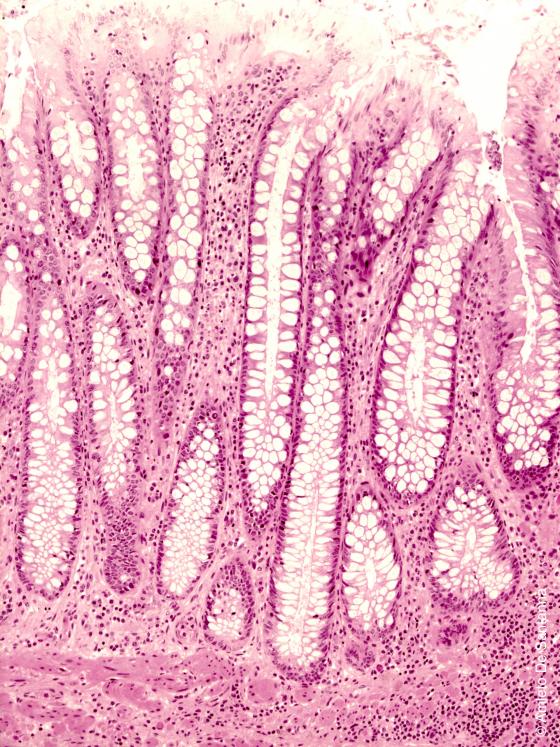 Figura E26. Colon umano a forte ingrandimento