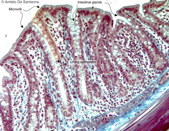 Figure E27. Rat colon