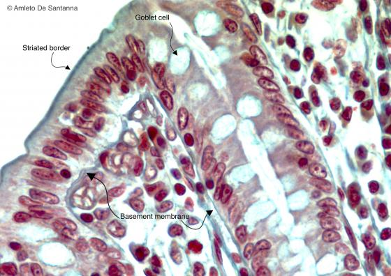 Figure E28. Rat colon