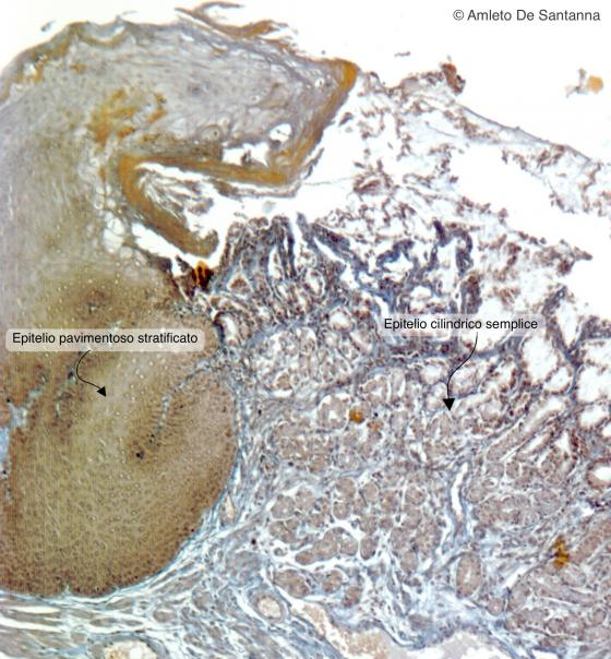 Figura E33. Giunzione gastro-esofagea di coniglio