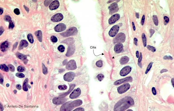 Figure E37. Human oviduct