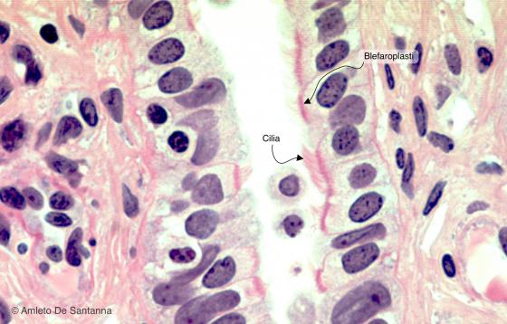 Figura E37. Tube uterine