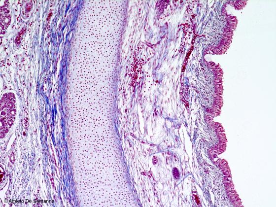 Figura E42. Trachea umana