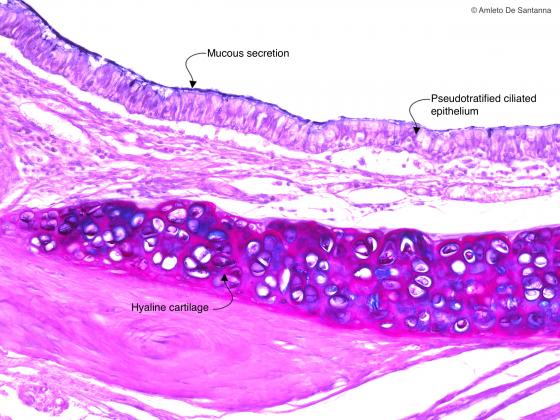 Figure E44. Mouse trachea