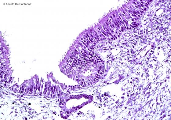 Figura E46. Trachea umana