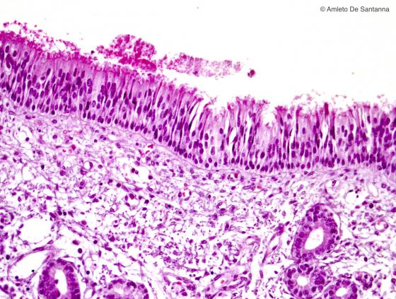 Figura E47. Cavità nasali di feto umano