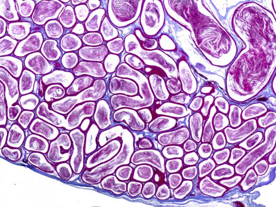 Figura E51. Epididimo di ratto