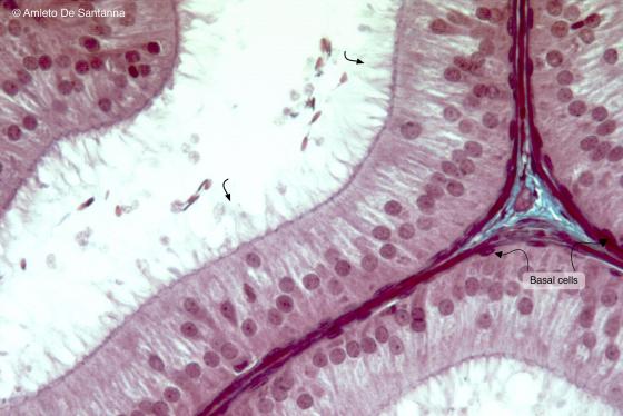 Figure E54. Rabbit epididymis