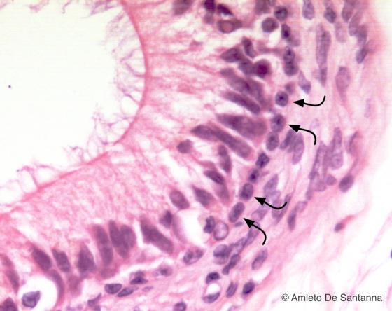 Figura E55. Epididimo umano