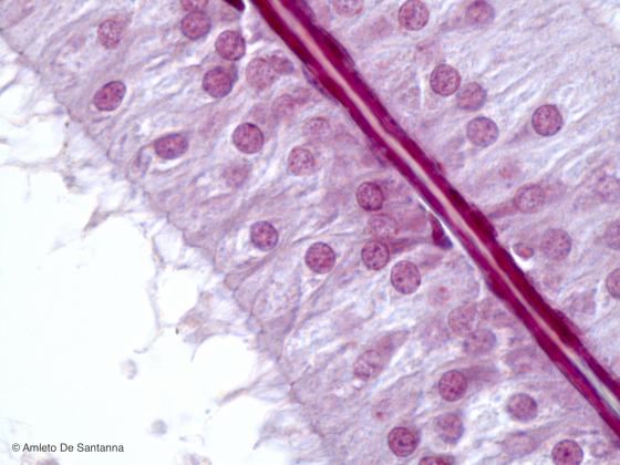 Figura E56. Epididimo di coniglio