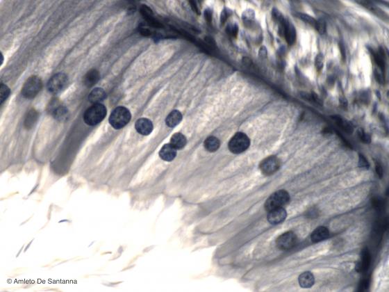 Figura E57. Epididimo di topo a forte ingrandimento