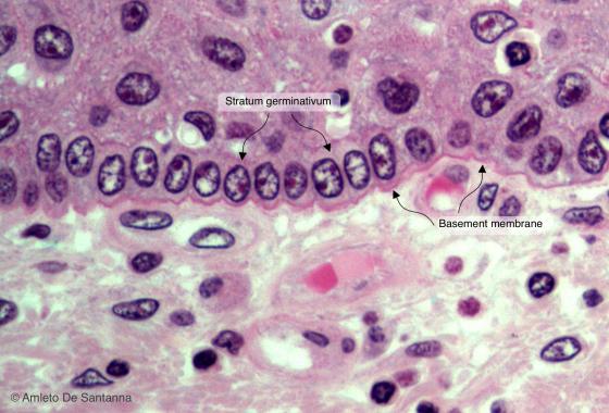 Figure E78. Human skin