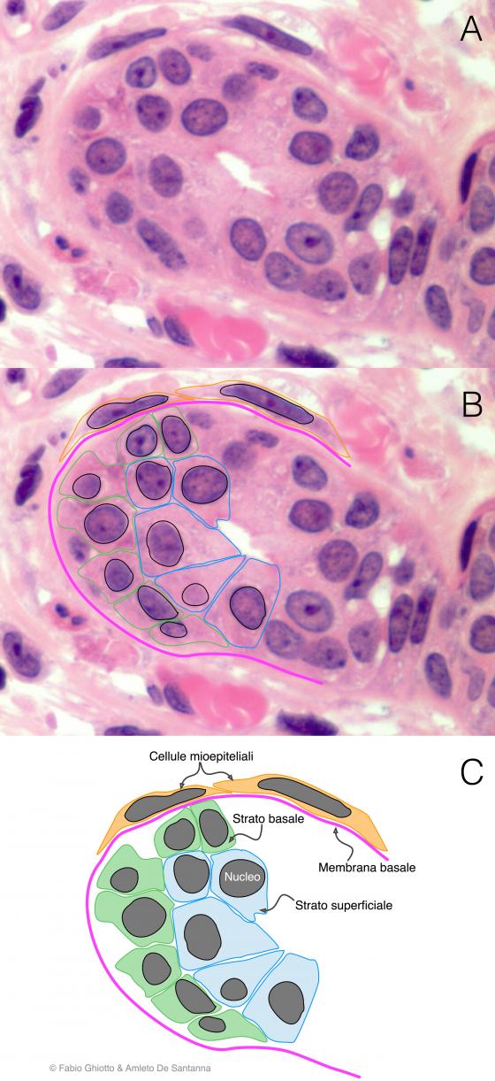 Figura E86. Micrografia di epitelio cubico o isoprismatico stratificato annotata digitalmente