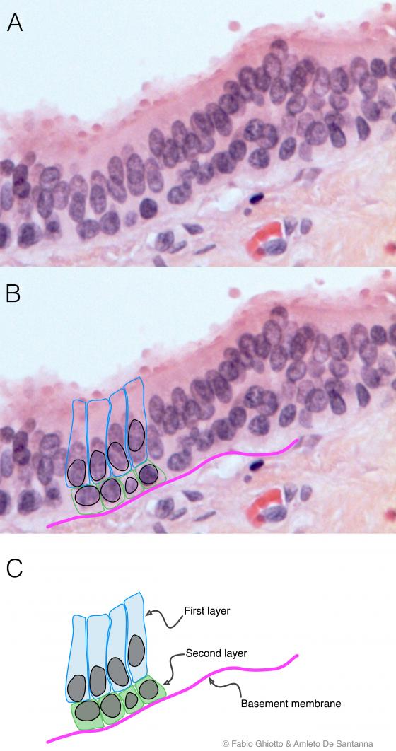 Figure E90. Digitally annotated micrograph of stratified columnar epithelium