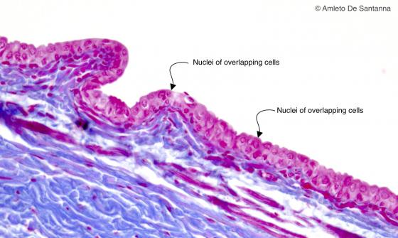 Figure E92. Human eyelid