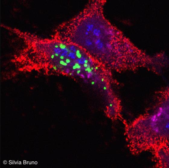 Figura S37 Cellule HeLa transfettate con PML-GFP