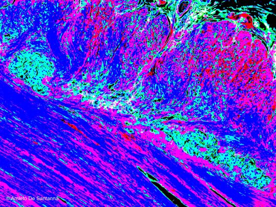 Figura S39 Esempio di micrografia elaborata digitalmente