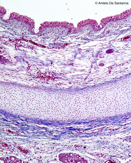 Figura S7 Trachea di feto umano