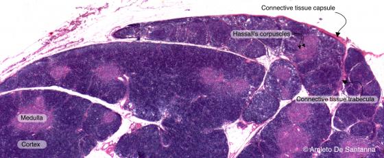 Figure C114A. Human thymus