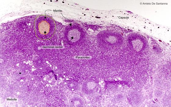 Figure C126A. Human lymph node