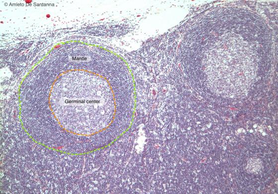 Figure C129. Human lymph node at higher magnification