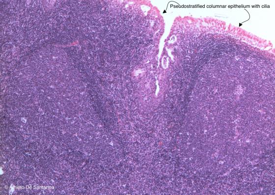 Figure C135. Human pharyngeal tonsil