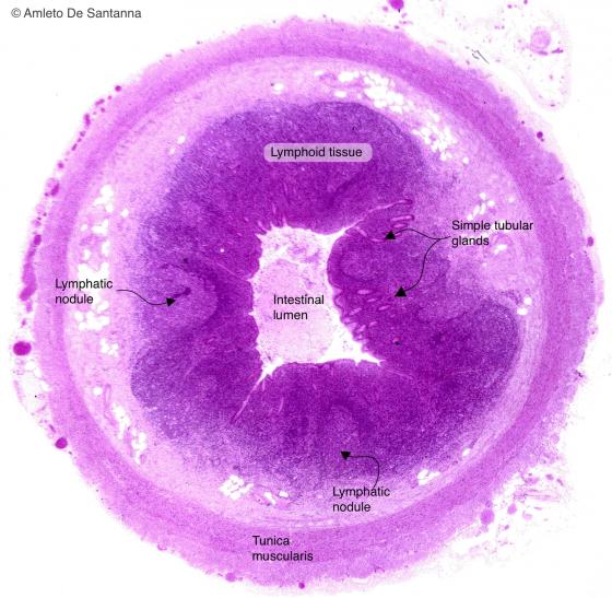 Figure C137A. Human vermiform appendix