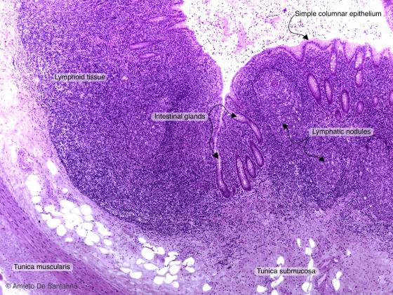 Figure C138A. Human vermiform appendix