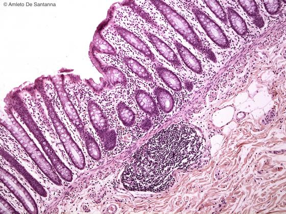 Figura C140. Colon umano